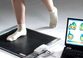 Hallux valgus diagnosis