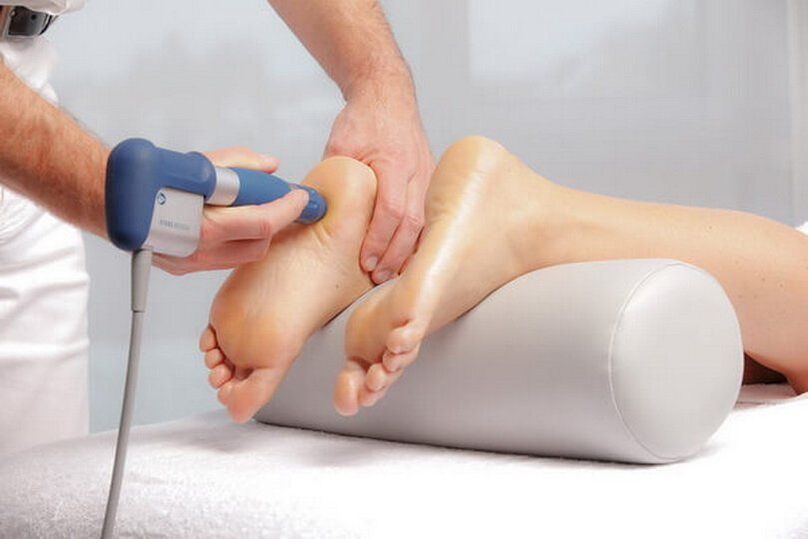 Performing shock wave therapy