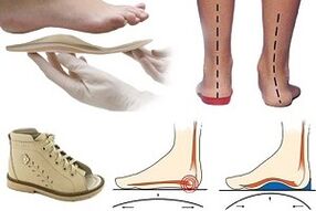 orthopedic shoes for hallux valgus in children