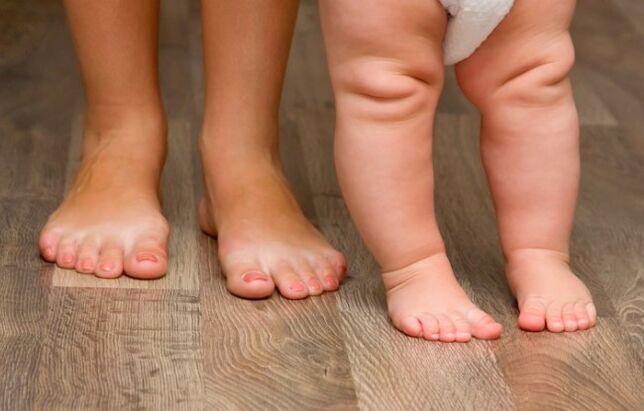 Valgo deformation of the foot to children